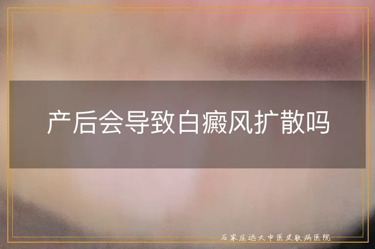 产后会导致白癜风扩散吗