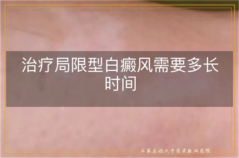 治疗局限型白癜风需要多长时间