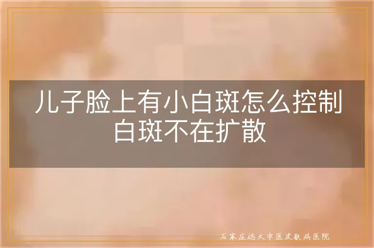 儿子脸上有小白斑怎么控制白斑不在扩散