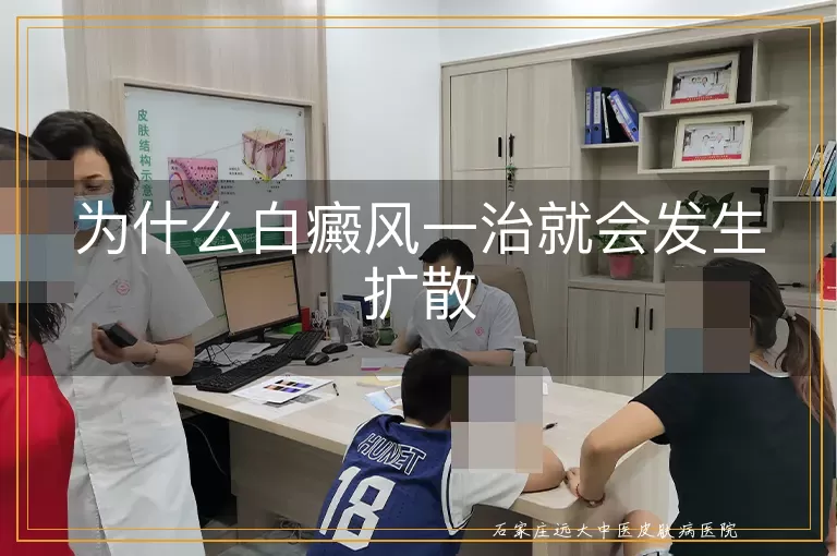 为什么白癜风一治就会发生扩散