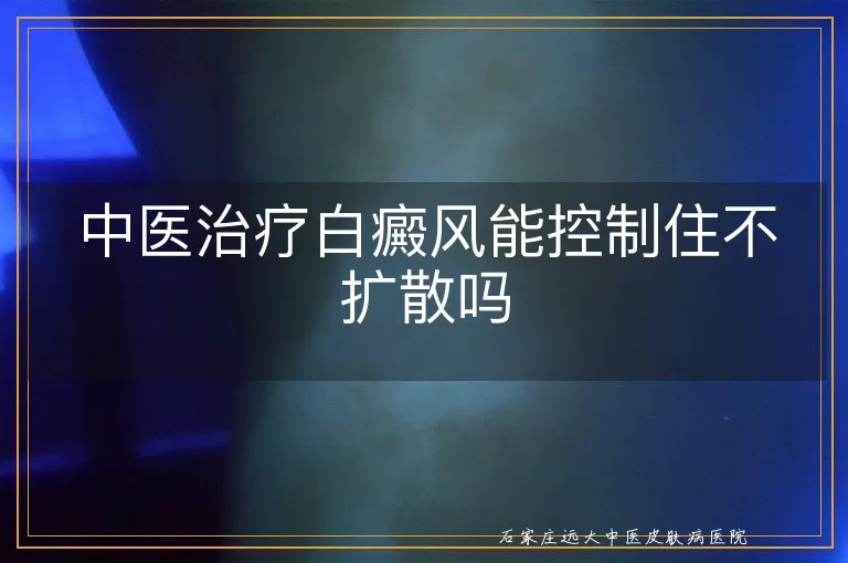中医治疗白癜风能控制住不扩散吗