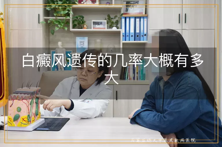白癜风遗传的几率大概有多大