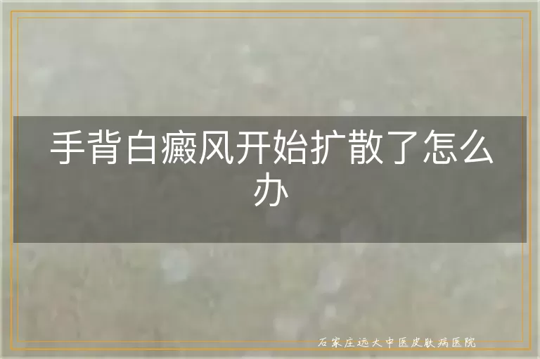 手背白癜风开始扩散了怎么办