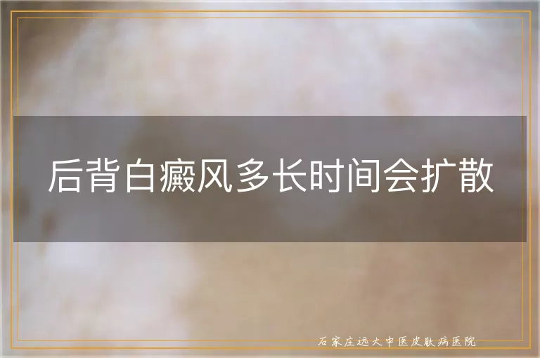 后背白癜风多长时间会扩散