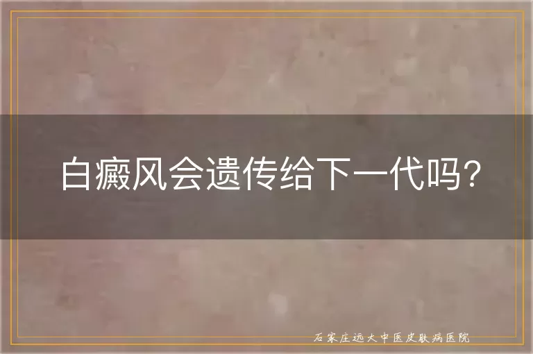 白癜风会遗传给下一代吗?