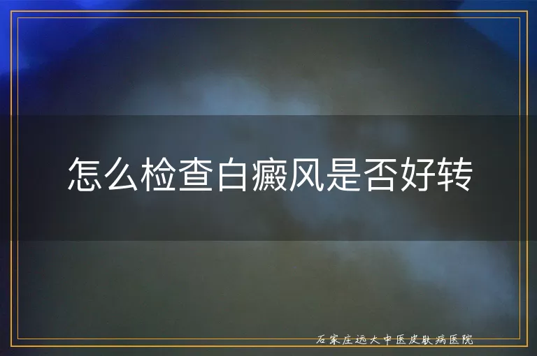 怎么检查白癜风是否好转