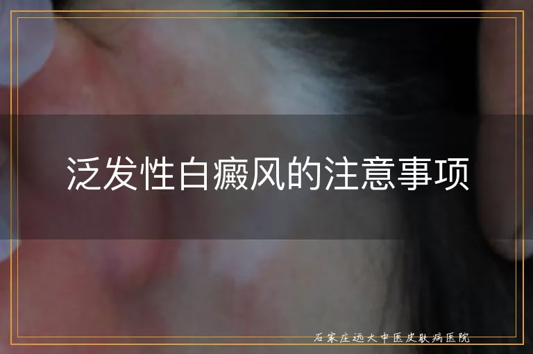 泛发性白癜风的注意事项