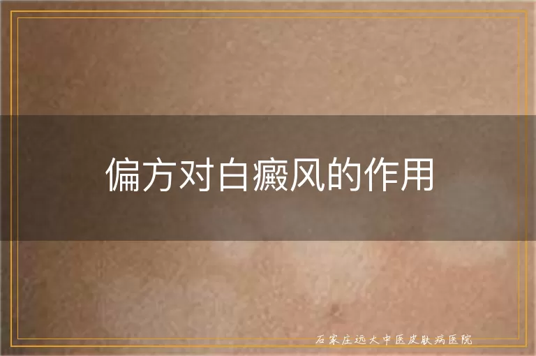 偏方对白癜风的作用