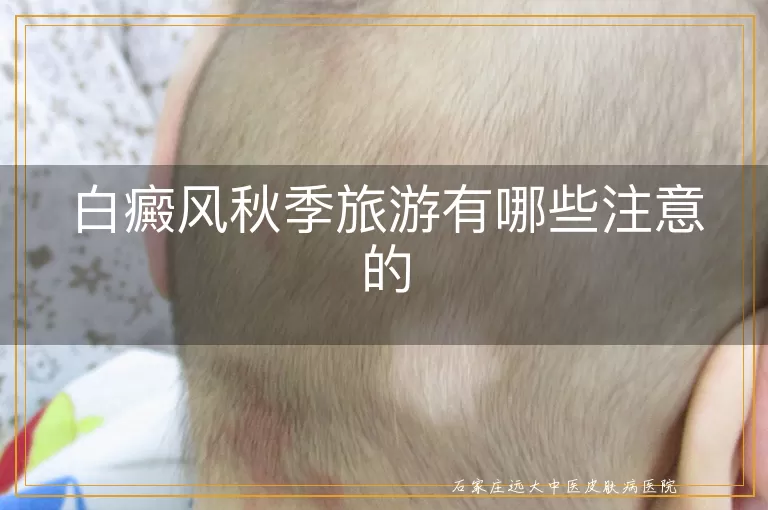 白癜风秋季旅游有哪些注意的