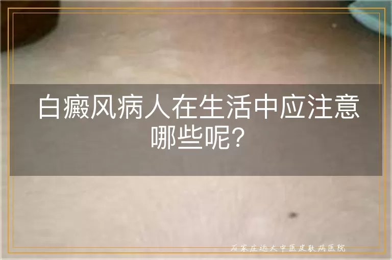 白癜风病人在生活中应注意哪些呢?