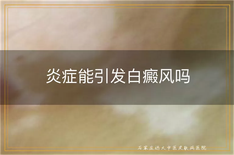 炎症能引发白癜风吗