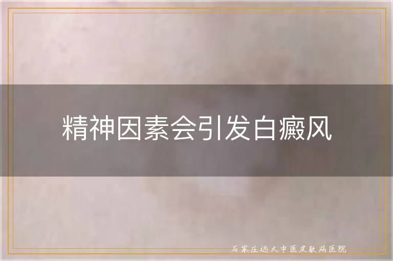精神因素会引发白癜风