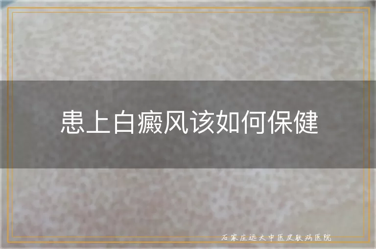 患上白癜风该如何保健