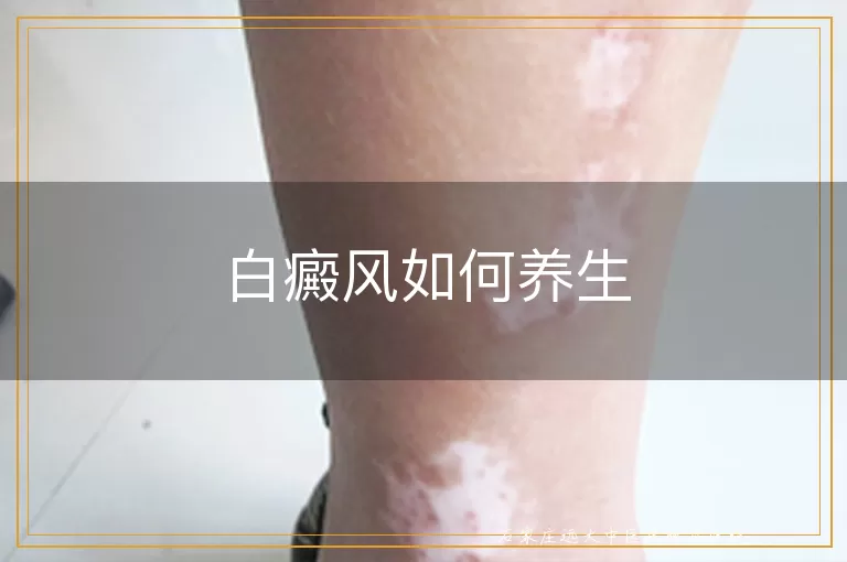 白癜风如何养生