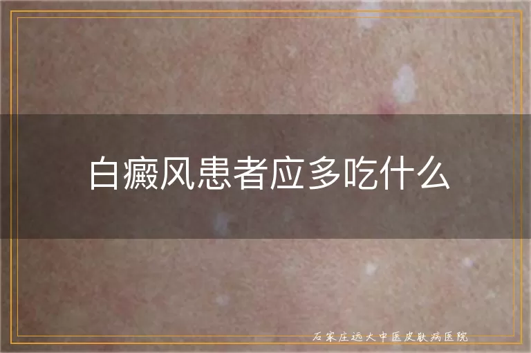 白癜风患者应多吃什么