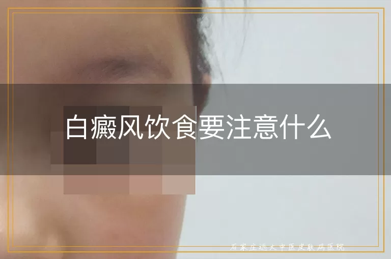 白癜风饮食要注意什么