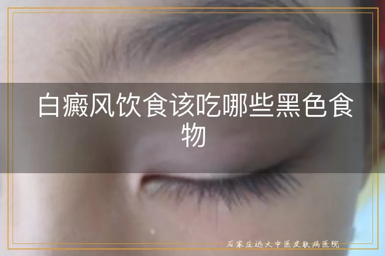 白癜风饮食该吃哪些黑色食物