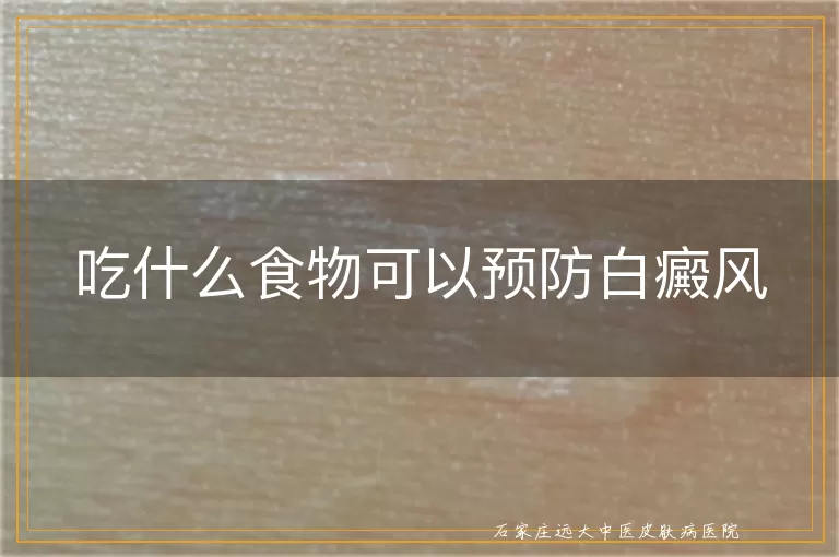 吃什么食物可以预防白癜风