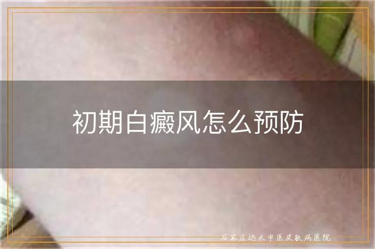 初期白癜风怎么预防