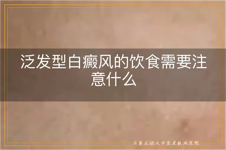 泛发型白癜风的饮食需要注意什么