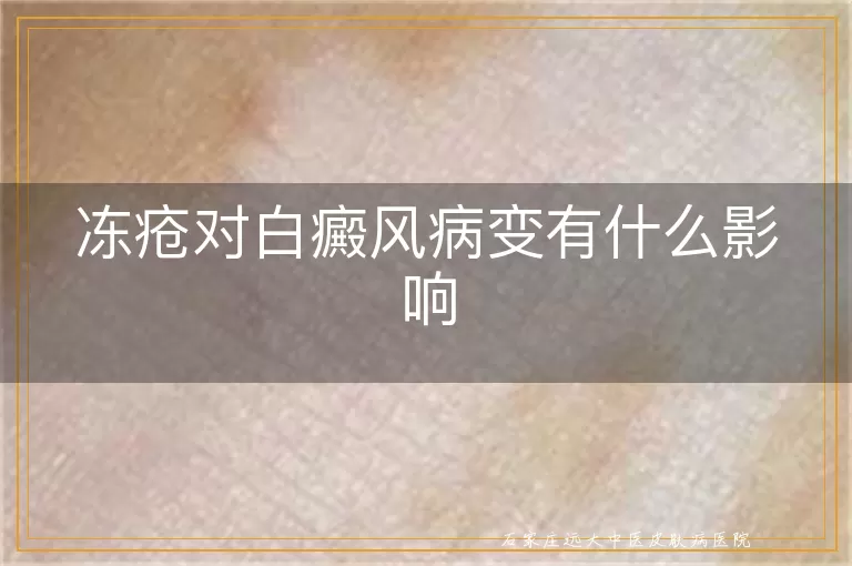冻疮对白癜风病变有什么影响