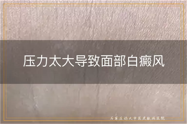 压力太大导致面部白癜风