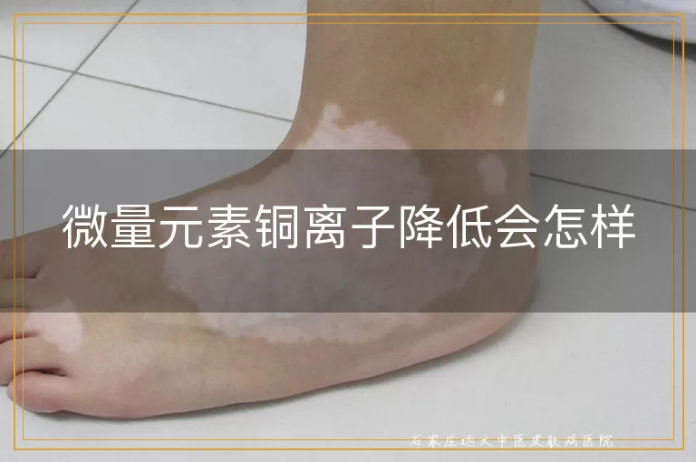微量元素铜离子降低会怎样