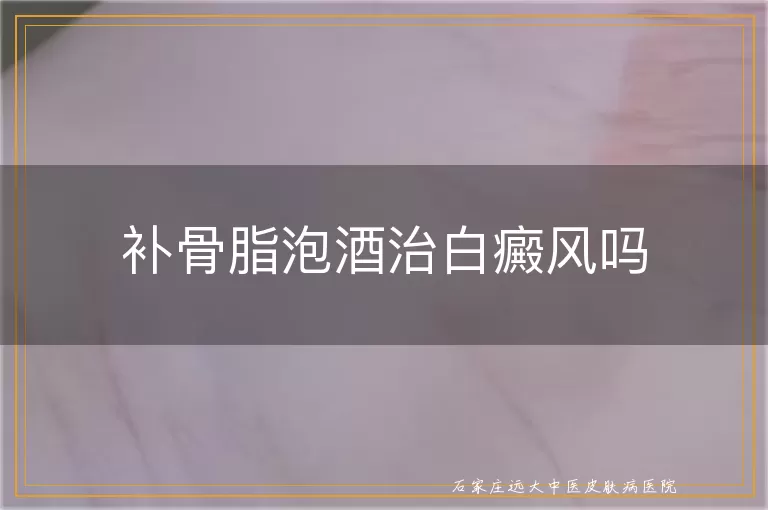 补骨脂泡酒治白癜风吗