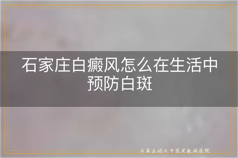 石家庄白癜风怎么在生活中预防白斑