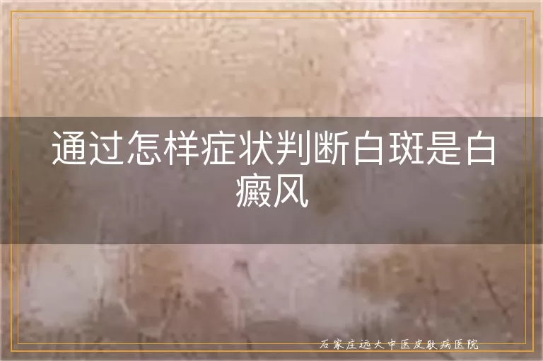 通过怎样症状判断白斑是白癜风