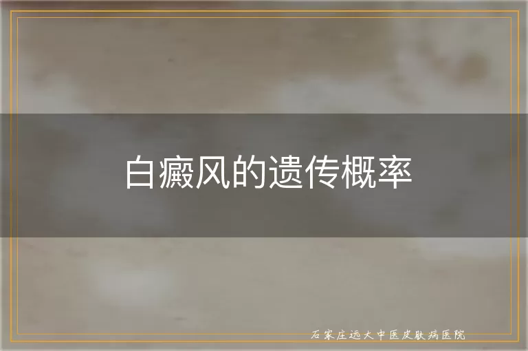 白癜风的遗传概率