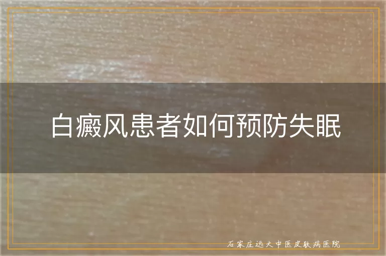 白癜风患者如何预防失眠