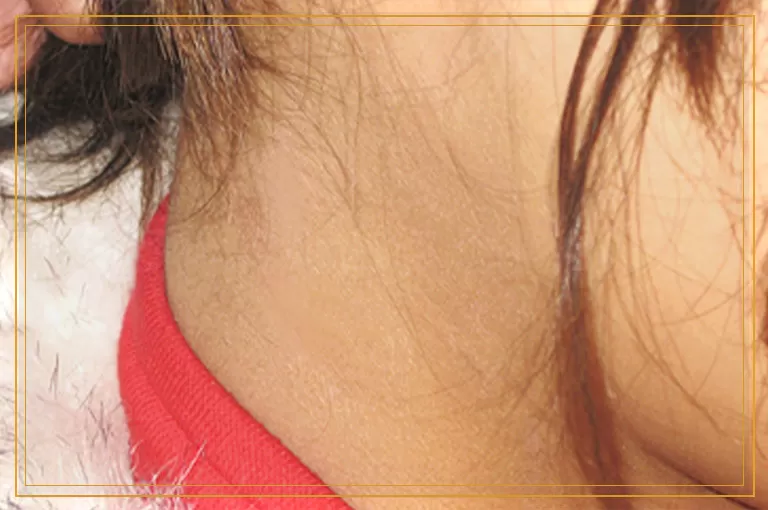 十多年的小白点还能治好吗