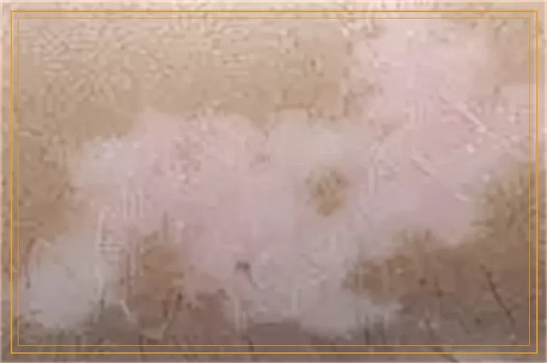 做全套白癜风检查一共多少钱