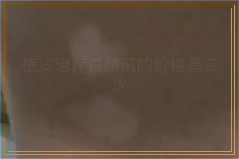 植皮治疗白癜风的价格是多少
