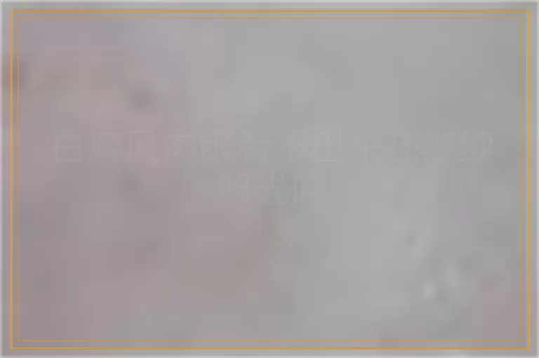 白癜风肉眼看不出来还继续照光吗