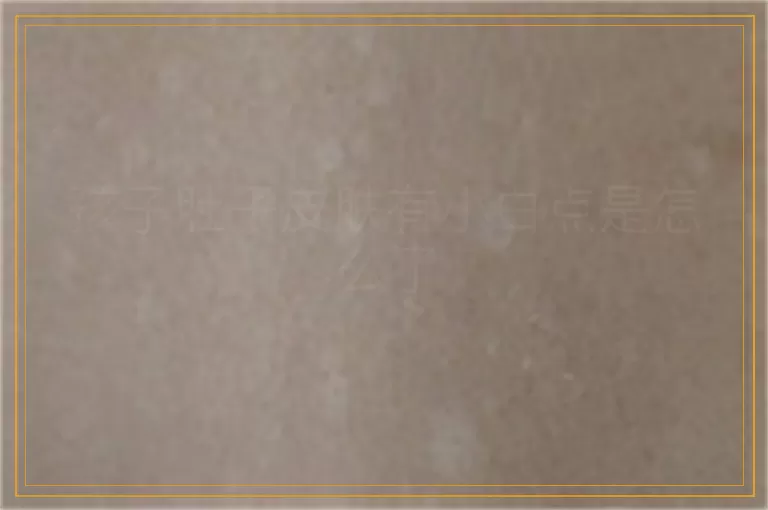 孩子肚子皮肤有小白点是怎么了