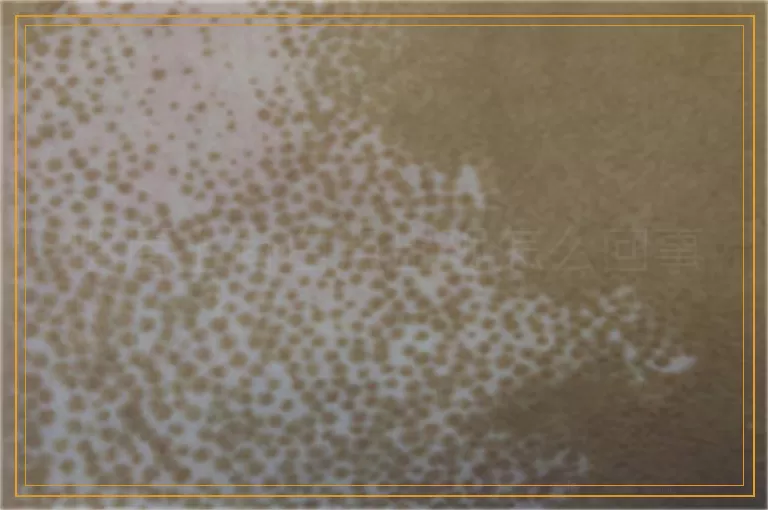 嘴唇上有白点出现怎么回事