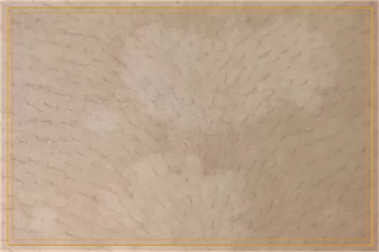 皮肤长白斑诊疗方法中哪个比较准确