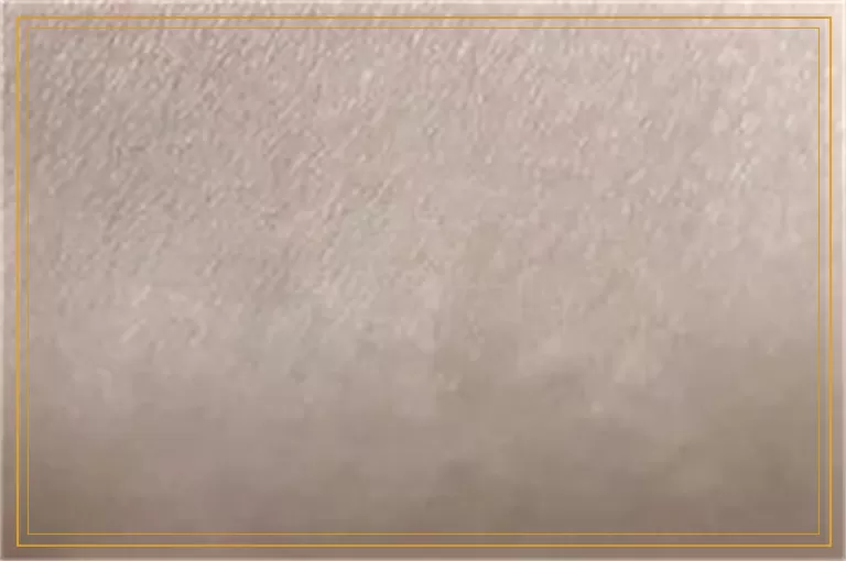 白癜风紫外线光疗和照308效果区别大吗