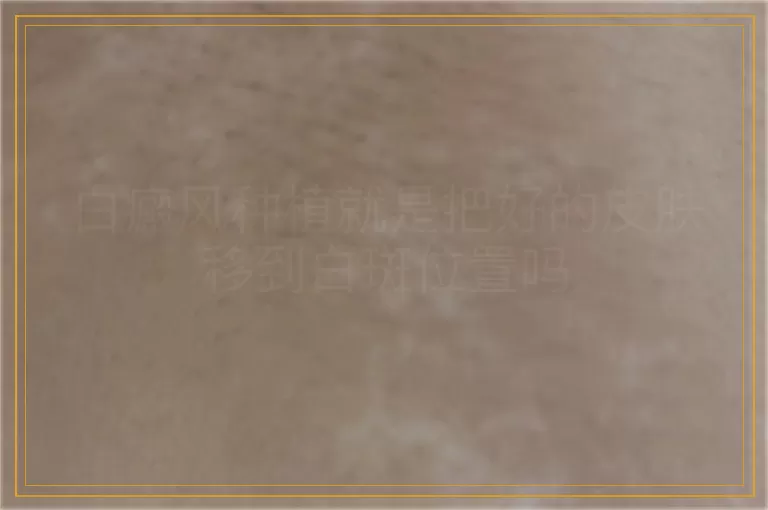 白癜风种植就是把好的皮肤移到白斑位置吗