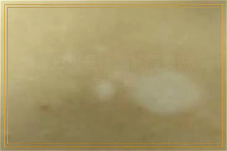 确诊白斑是什么病需要做哪些检查