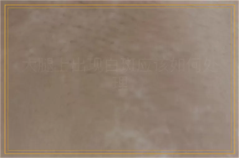大腿上出现白斑应该如何处理