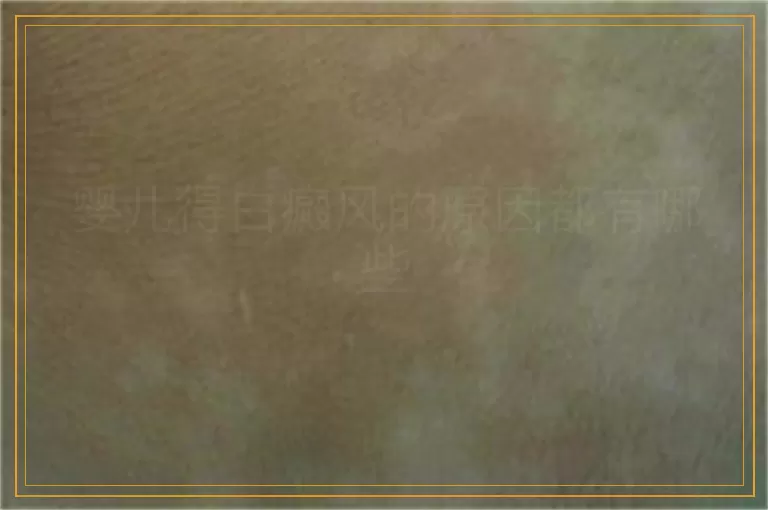 婴儿得白癜风的原因都有哪些