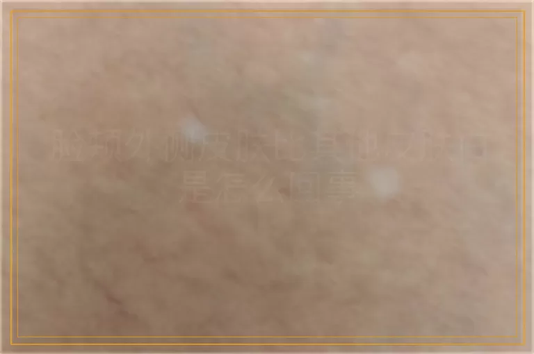 脸颊外侧皮肤比其他皮肤白是怎么回事