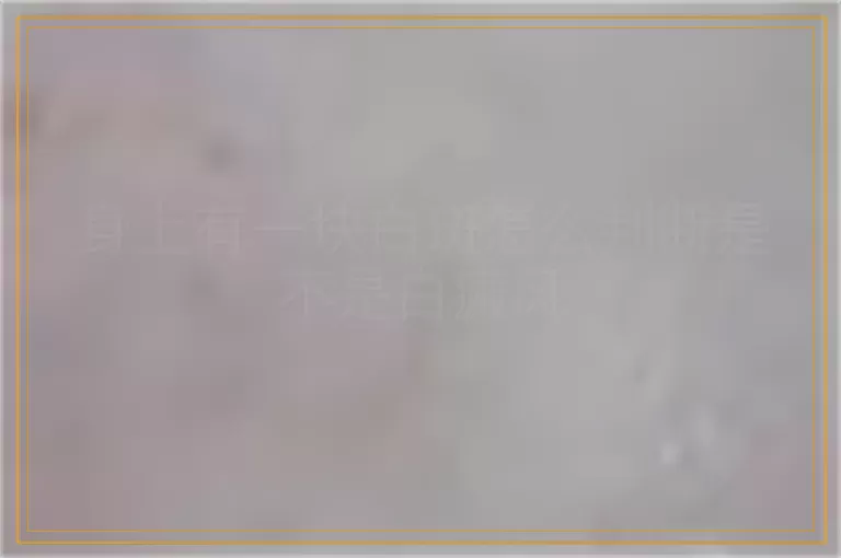 身上有一块白斑怎么判断是不是白癜风