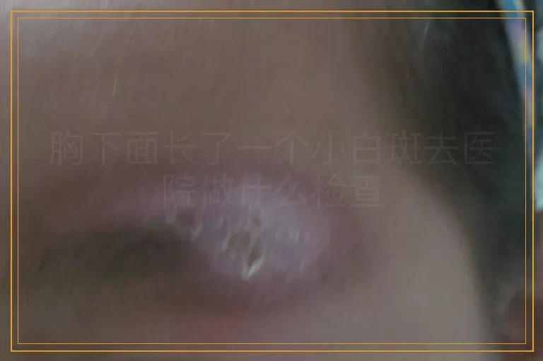 胸下面长了一个小白斑去医院做什么检查
