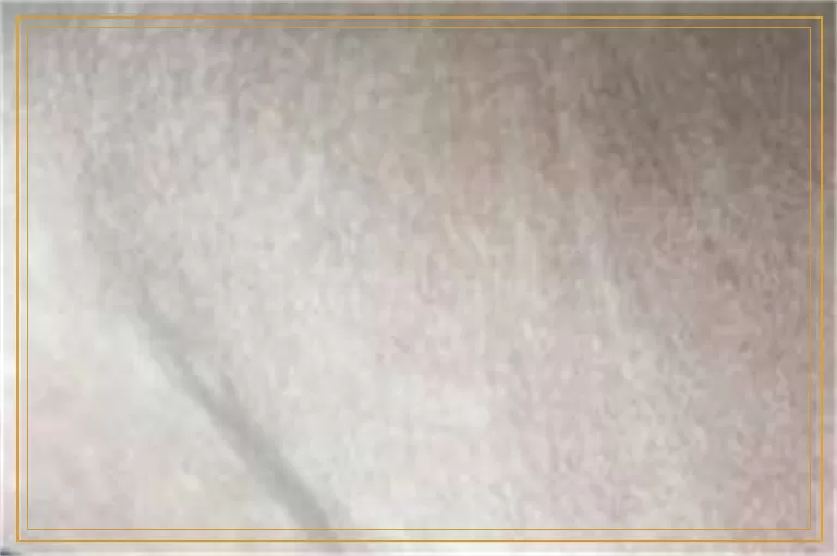 胳膊上小米粒大小白点有必要治疗吗