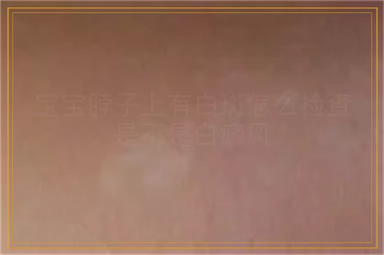 宝宝脖子上有白斑怎么检查是不是白癜风