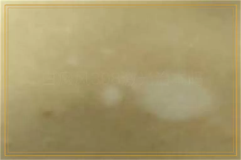 白癜风308激光治本吗